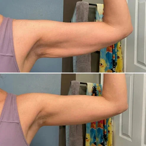 Armivia Arm Sleeve 3