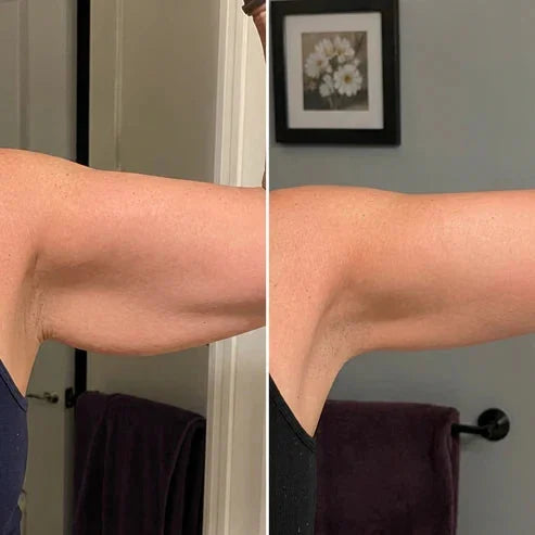 Armivia Arm Sleeve 6